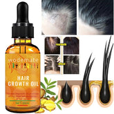 Ginger Hair Growth Serum Essential Oil Anti Hair Loss Fast Grow Hair Growth Oil Essential Oil Treatments Health Care Beauty 30ml