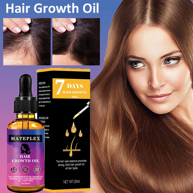 30ml Hair Growth Serum Essential Oil Anti Hair Loss Fast Grow Hair Growth Oil Essential Oil Treatments Health Care Beauty Ginger