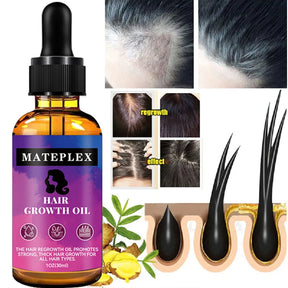 30ml Hair Growth Serum Essential Oil Anti Hair Loss Fast Grow Hair Growth Oil Essential Oil Treatments Health Care Beauty Ginger